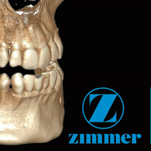 Zfx™ Dicom Viewer - Software Upgrade