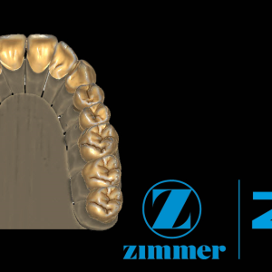 Zfx™ TruSmile - Software Upgrade